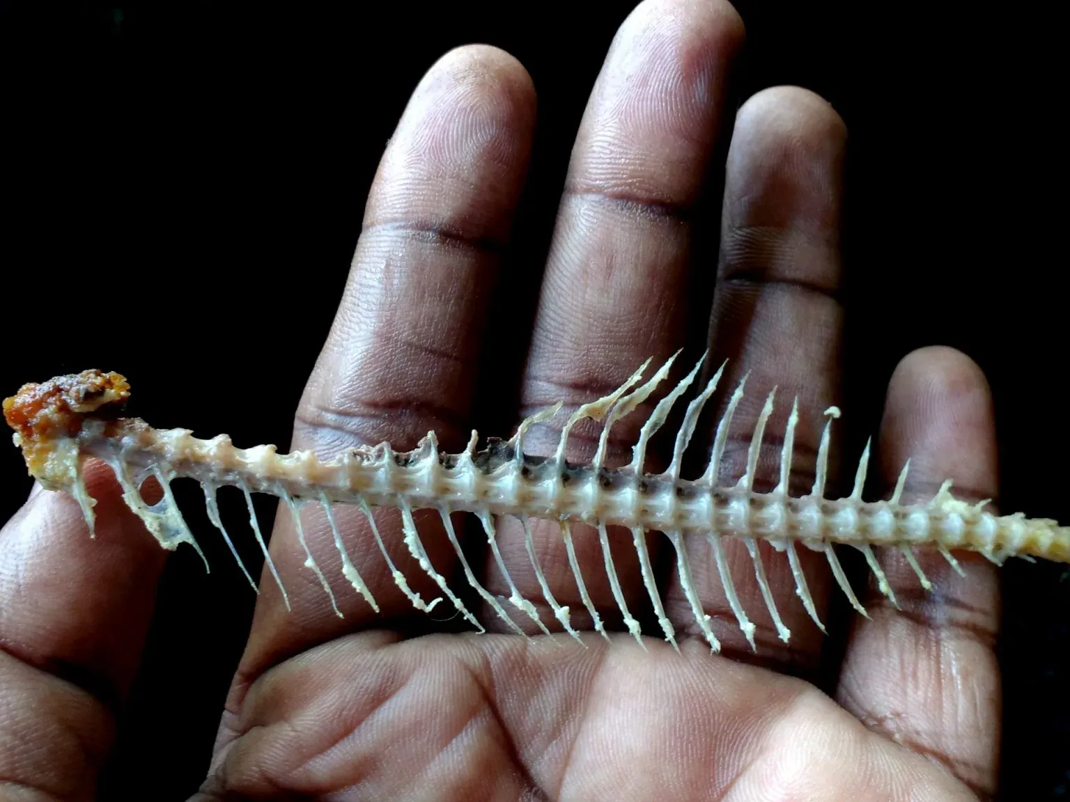 Apa Nak Buat Kalau Tercekik Tulang Ikan?