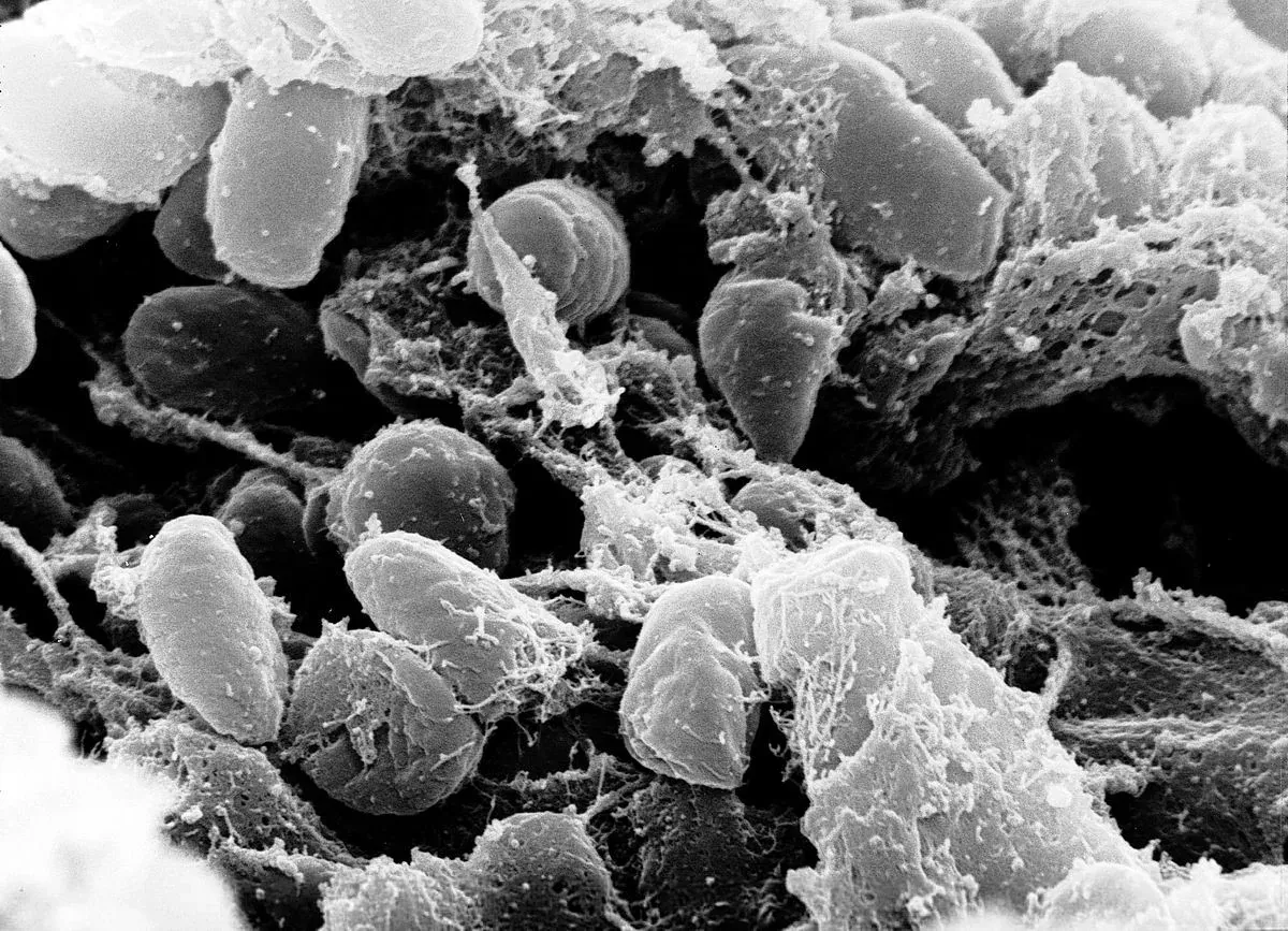 Yersinia Pestis – Alkisah Bakteria Yang Meragut Lebih 300 Juta Nyawa Dalam Sejarah