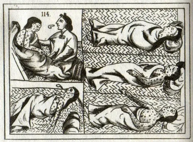 Wabak Cacar (Smallpox) Membunuh 30 Juta Nyawa Aztec