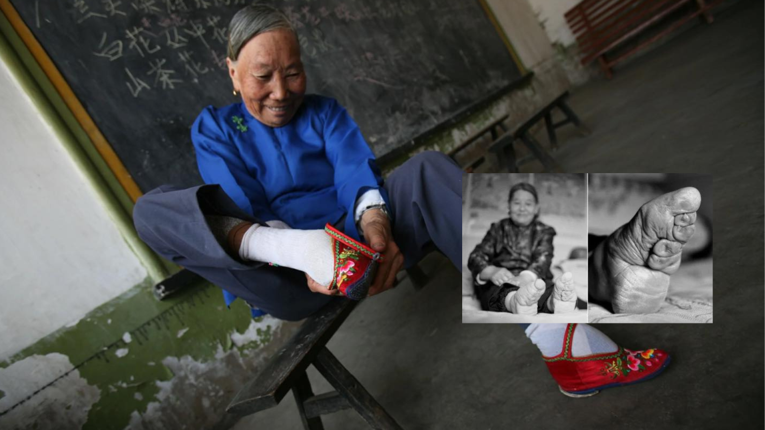 Tradisi Foot Binding Cina Yang Mengerikan?